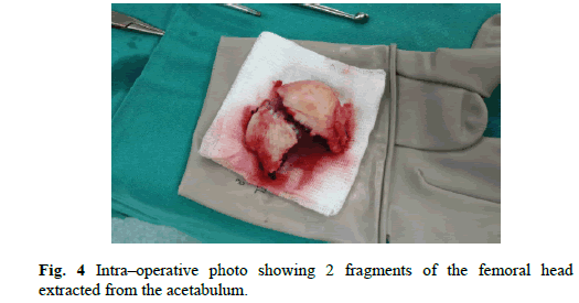 Orthopaedics-Trauma-Surgery-Related-Research-Intra-operative