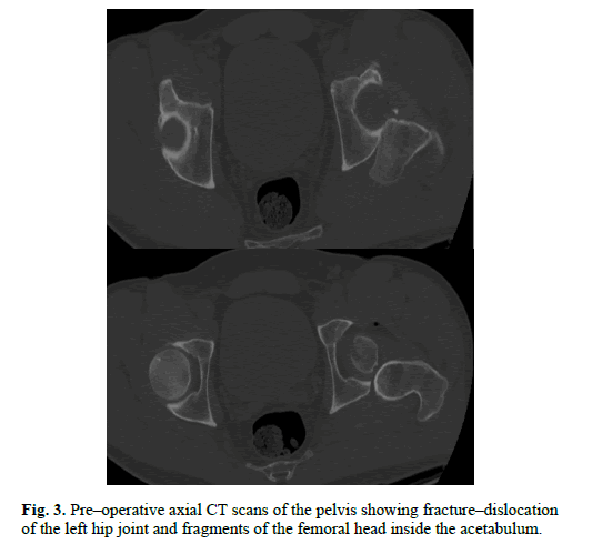 Orthopaedics-Trauma-Surgery-Related-Research-fragments