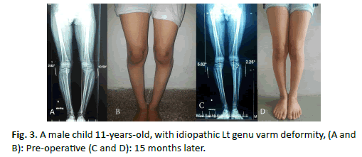Orthopaedics-Trauma-Surgery-Related-Research-idiopathic