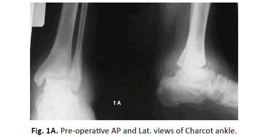 Orthopaedics-Trauma-Surgery-Related-Research-operative