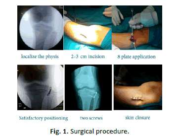 Orthopaedics-Trauma-Surgery-Related-Research-procedure