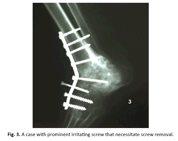 Orthopaedics-Trauma-Surgery-Related-Research-prominent