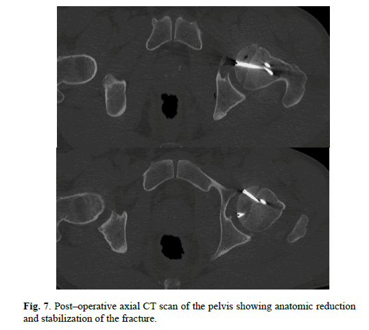 Orthopaedics-Trauma-Surgery-Related-Research-reduction