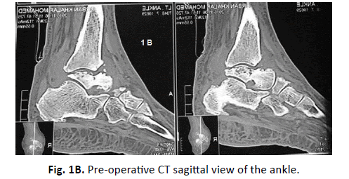 Orthopaedics-Trauma-Surgery-Related-Research-sagittal