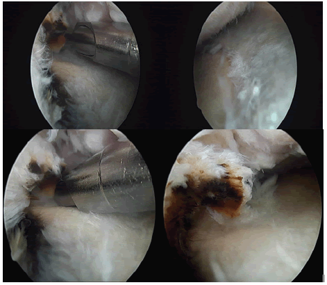 jotsrr-Arthroscopy