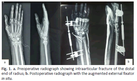 jotsrr-radiograph