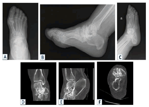 jotsrr-radiographs