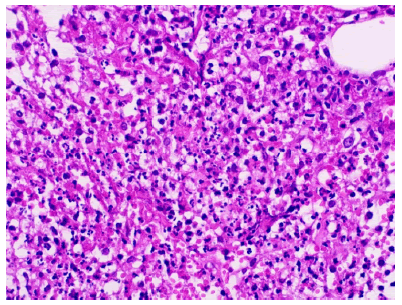 jotsrr-investigation-Histopathology