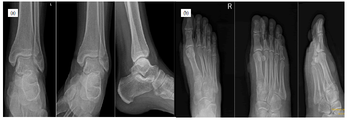 jotsrr-investigation-Radiograph