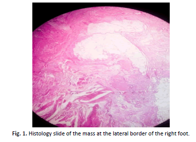 Orthopaedics-Histology-slide-mass