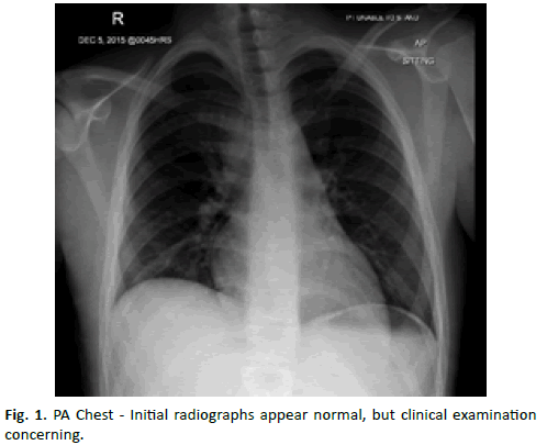 Orthopaedics-Trauma-Surgery-PA-Chest-Initial-radiographs