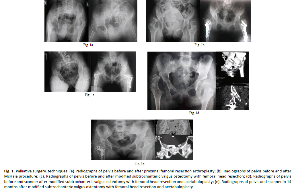 Orthopaedics-Trauma-Surgery-Palliative-surgery-techniques