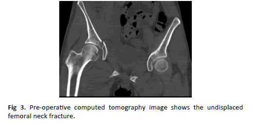 Orthopaedics-Trauma-Surgery-Pre-operative-computed-tomography