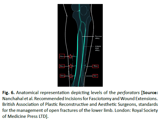 Orthopaedics-Trauma-Surgery-Related-Research-Anatomical-representation-depicting