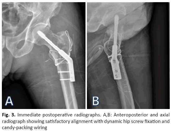 Orthopaedics-Trauma-Surgery-Related-Research-Anteroposterior-axial