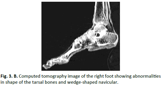 Orthopaedics-Trauma-Surgery-Related-Research-Computed-tomography