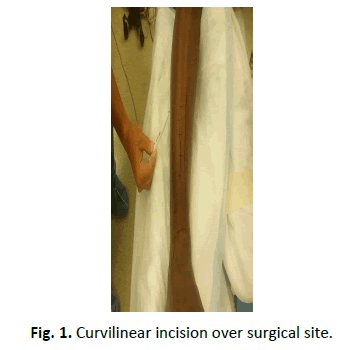 Orthopaedics-Trauma-Surgery-Related-Research-Curvilinear-incision