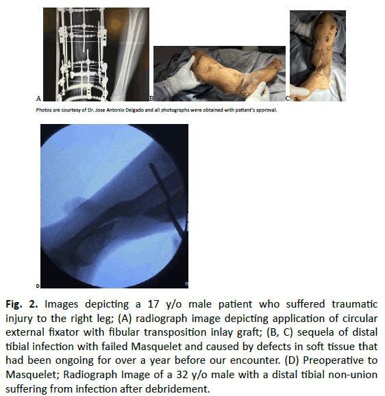 Orthopaedics-Trauma-Surgery-Related-Research-Images-depicting