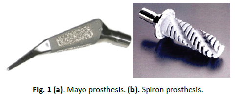 Orthopaedics-Trauma-Surgery-Related-Research-Mayo-prosthesis