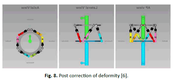 Orthopaedics-Trauma-Surgery-Related-Research-Post-correction