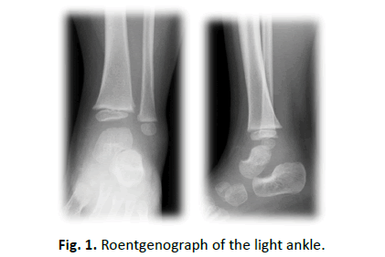 Orthopaedics-Trauma-Surgery-Related-Research-Roentgenograph