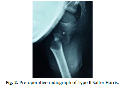 Orthopaedics-Trauma-Surgery-Related-Research-Salter-Harris