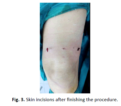 Orthopaedics-Trauma-Surgery-Related-Research-Skin-incisions
