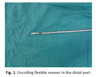 Orthopaedics-Trauma-Surgery-Related-Research-Uncoiling-flexible