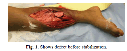 Orthopaedics-Trauma-Surgery-Related-Research-before-stabilization