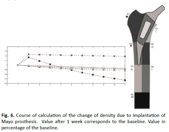 Orthopaedics-Trauma-Surgery-Related-Research-density-implantation