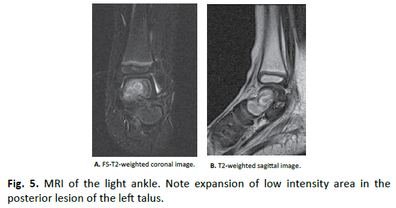 Orthopaedics-Trauma-Surgery-Related-Research-expansion-low-intensity