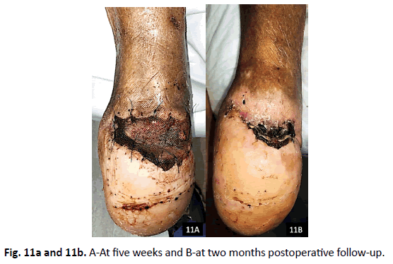 Orthopaedics-Trauma-Surgery-Related-Research-five-weeks