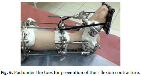Orthopaedics-Trauma-Surgery-Related-Research-flexion