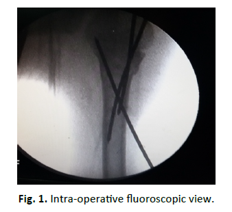 Orthopaedics-Trauma-Surgery-Related-Research-fluoroscopic-view