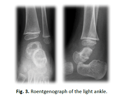 Orthopaedics-Trauma-Surgery-Related-Research-light-ankle