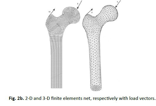 Orthopaedics-Trauma-Surgery-Related-Research-load-vectors