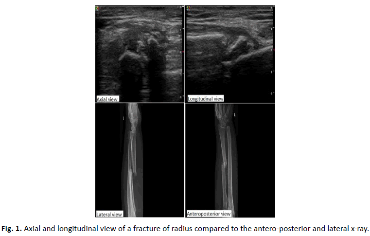 Orthopaedics-Trauma-Surgery-Related-Research-longitudinal-view