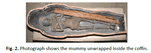 Orthopaedics-Trauma-Surgery-Related-Research-mummy-unwrapped