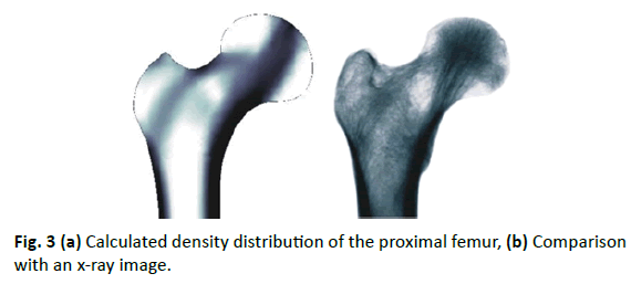 Orthopaedics-Trauma-Surgery-Related-Research-proximal-femur