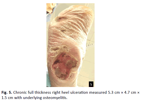 Orthopaedics-Trauma-Surgery-Related-Research-right-heel