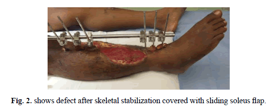 Orthopaedics-Trauma-Surgery-Related-Research-skeletal-stabilization