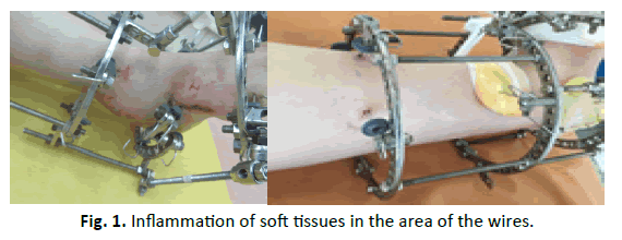 Orthopaedics-Trauma-Surgery-Related-Research-soft-tissues