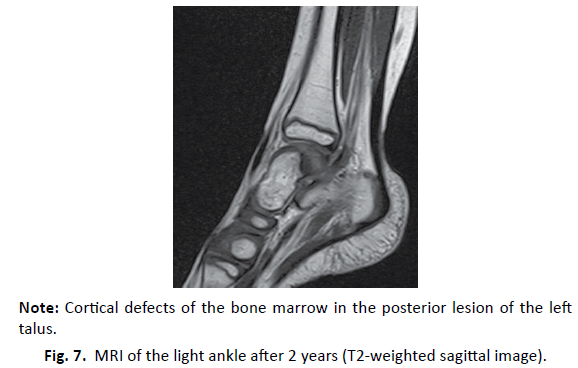 Orthopaedics-Trauma-Surgery-Related-Research-weighted-sagittal-image