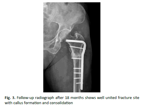 Orthopaedics-Trauma-Surgery-consolidation