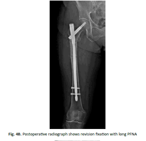 Orthopaedics-Trauma-Surgery-fixation