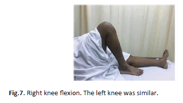 Orthopaedics-Trauma-Surgery-flexion