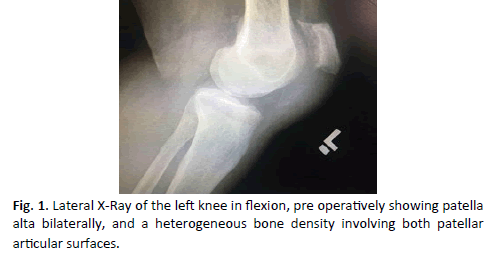 Orthopaedics-Trauma-Surgery-heterogeneous