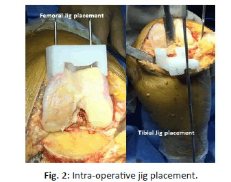 Orthopaedics-Trauma-Surgery-intra-operative