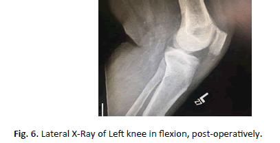 Orthopaedics-Trauma-Surgery-left-knee