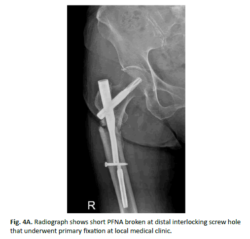 Orthopaedics-Trauma-Surgery-medical